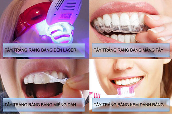 So sáng tẩy trắng răng Laser Whitening với các phương pháp phổ biến khác So sáng tẩy trắng răng Laser Whitening với các phương pháp phổ biến khác