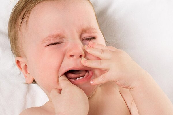 Nguyên nhân gây ra nhiệt miệng ở trẻ