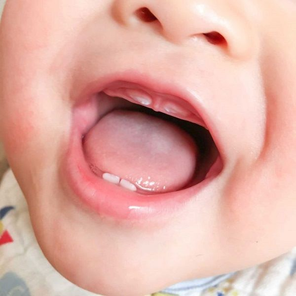 Cách chăm sóc trẻ mọc răng như thế nào cho đúng? Cách chăm sóc trẻ mọc răng như thế nào cho đúng?