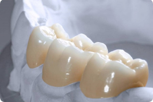 Các yếu tố quyết định giá cả của bọc răng sứ