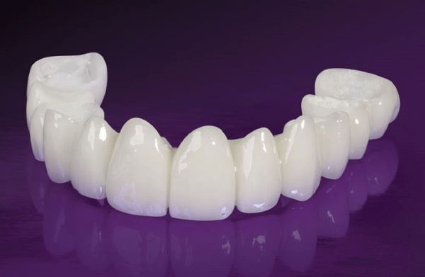Răng sứ Lava là gì? Của nước nào sản xuất? Răng sứ Lava là gì? Của nước nào sản xuất?