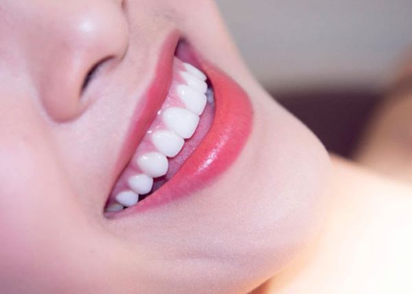 Ưu và nhược điểm của sứ Lava Plus là gì? Ưu và nhược điểm của sứ Lava Plus là gì?