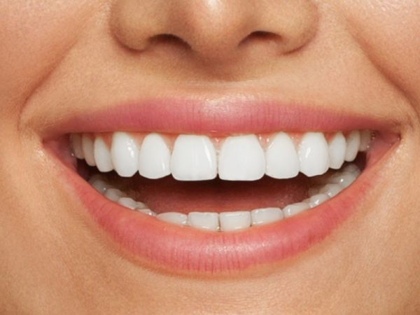 Giá bọc răng Lava Plus là bao nhiêu? Giá bọc răng Lava Plus là bao nhiêu?