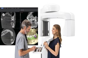 Chụp CT conebeam là gì? Có chính xác và có ảnh hưởng gì đến sức khỏe không?