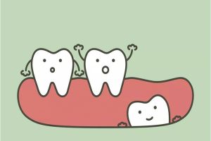 Nên nhổ răng khôn mọc thẳng hay không? Và những điều cần lưu ý