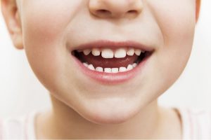 Trẻ chậm mọc răng nguyên nhân và giải pháp, tư vấn từ chuyên gia