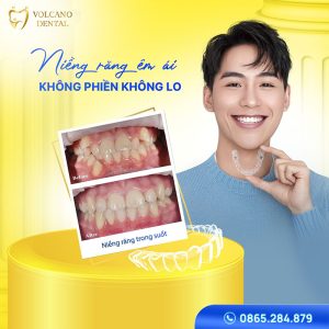 Niềng răng không đau, tiết kiệm và bền đẹp tại nha khoa Quốc tế Đồng