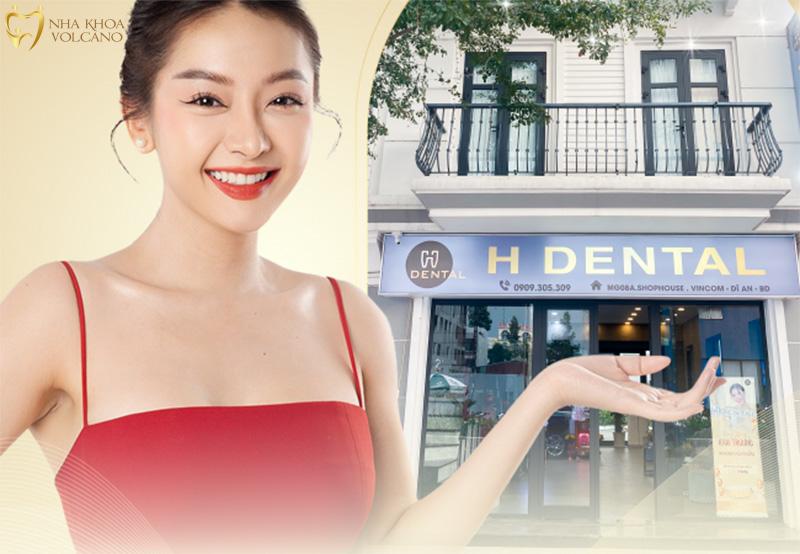 Lấy cao răng Nha khoa H Dental Lấy cao răng Nha khoa H Dental
