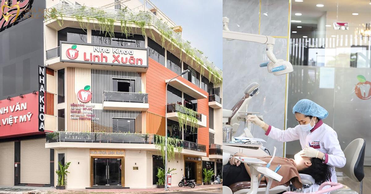 Lấy cao răng Nha khoa Linh Xuân Lấy cao răng Nha khoa Linh Xuân