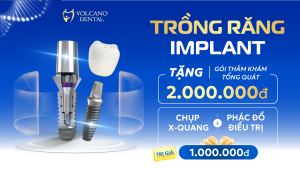 Chia sẻ link